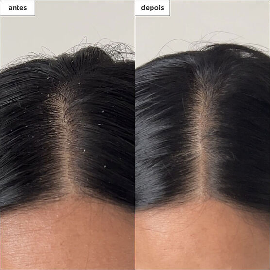 Scalp Revival Build-up Detox Spray